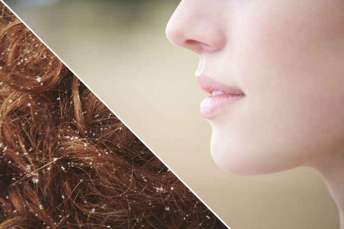haut-haare-pflege-kaelte Kälteschutz für Haut & Haar