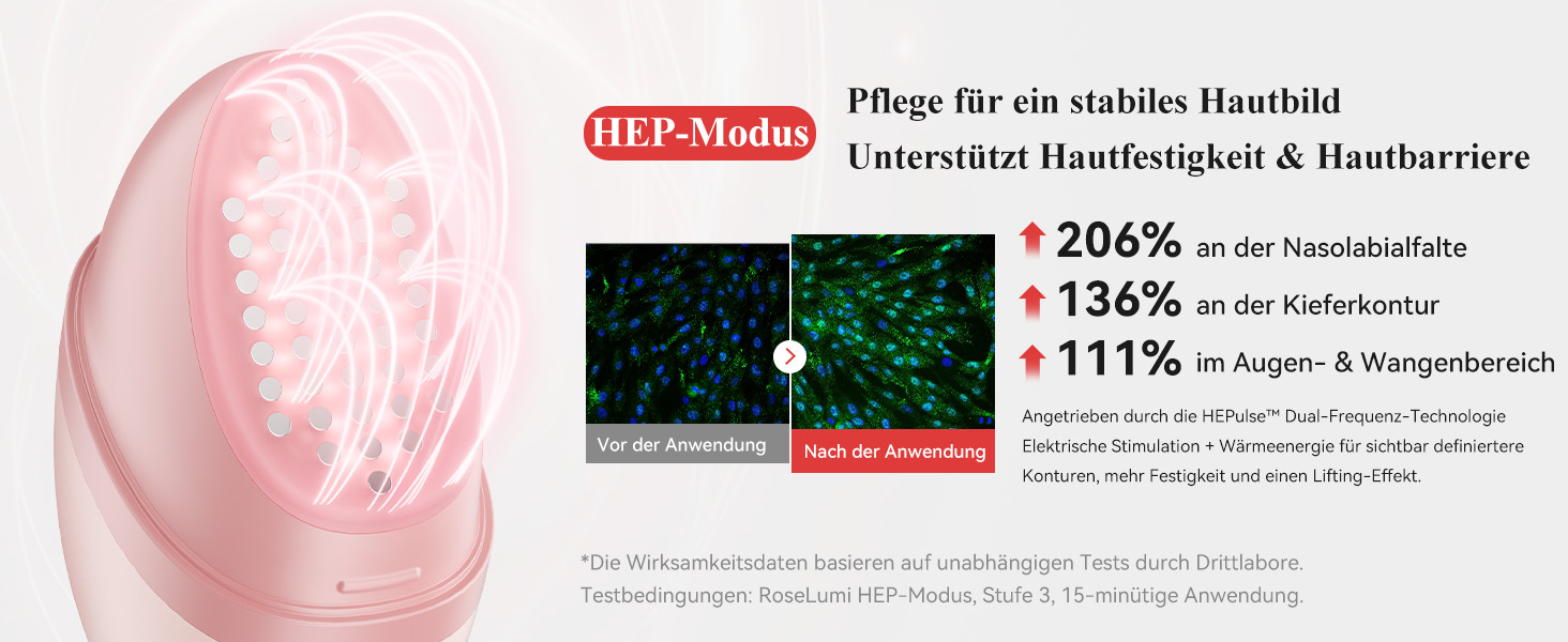 ANLAN Rose Lumi im Test: Was kann das Beauty-Device mit Pink Light, RF und HEPulse? 8 HEP-Modus