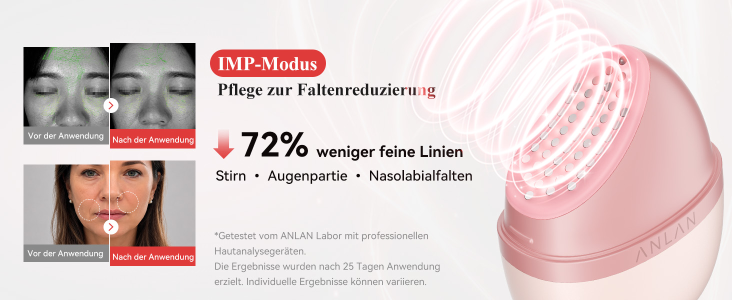 ANLAN Rose Lumi im Test: Was kann das Beauty-Device mit Pink Light, RF und HEPulse? 7 IMP-Modus